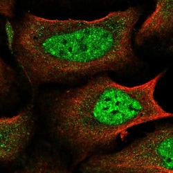 Abcam Anti-IKZF4 antibody, Quantity: Each of 1