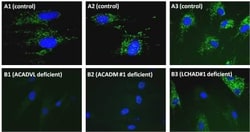 Abcam Human Fatty Acid Oxidation In-Cell ELISA Kit 96TEST, Quantity: Each