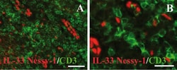 Abcam Anti-CD3 epsilon antibody [SP7], Quantity: Each of 1