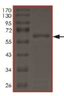 Abcam Recombinant human LIM Kinase 1 protein, 10UG, Quantity: Each of 1