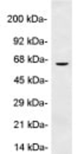 Abcam Anti-Perilipin-1 antibody, Quantity: Each of 1