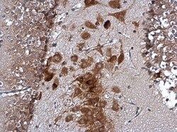 Abcam Anti-SCA2 antibody (ab227922) 100ul, Quantity: Each of 1