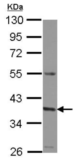 Abcam Anti-GNA11 antibody (ab153951) 100ul, Quantity: Each of 1
