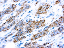 Diagnostic Biosystems HER2/NEU C-ERBB-2 c-erbB-2 Oncoprotein (SP3), Quantity: