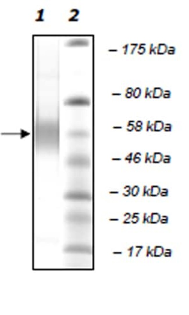 Abcam human PLA2G7 protein (Active) (ab271715) 20ug