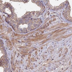 Abcam Anti-Ext1 antibody (ab126305) 100ul, Quantity: Each of 1