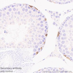 Abcam Recombinant Anti-Lin28A antibody [EPR24286-100] (ab279647) 100ul,