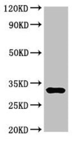 Abcam Anti-DNase I antibody, Quantity: Each of 1