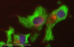 Abcam Anti-RIT1/RIT antibody (ab53720) 100ug, Quantity: Each of 1