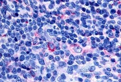 Abcam Anti-GPCR GPR65/TDAG8 antibody 50ug, Quantity: Each of 1