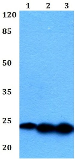 Abcam Anti-Interferon alpha 1 antibody (ab191903), Quantity: Each of 1