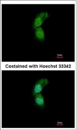 Abcam Anti-TRIM32 antibody (ab96612) 50ul, Quantity: Each of 1