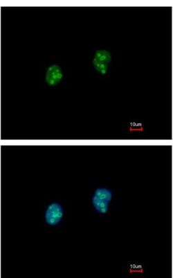 Abcam Anti-ISG20 antibody (ab154393) 100ul, Quantity: Each of 1