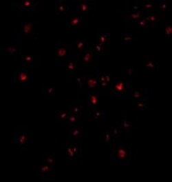 Abcam Anti-IRE1 antibody, Quantity: Each of 1