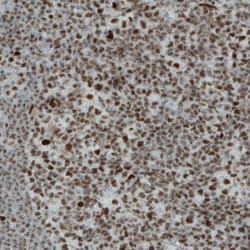 Abcam Anti-REST / NRSF antibody [CL0381] (ab211537), Quantity: Each of