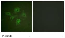 Abcam Anti-Eph receptor B1 + Eph receptor B2 (phospho Y594 + Y596) antibody,