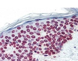 Abcam Anti-Lamin A + Lamin C antibody [JOL2], Quantity: Each of 1