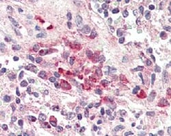 Abcam Anti-TREM2 antibody 50UG Mouse polyclonal, Quantity: Each of 1