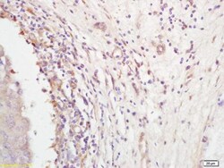 Abcam Anti-Follistatin antibody 100ul, Quantity: Each of 1
