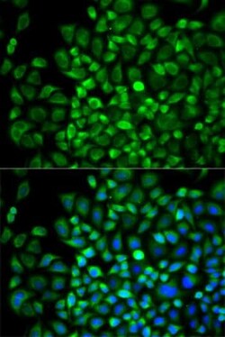 Abcam Anti-Angiopoietin-like 4/ANGPTL4 antibody (ab196746), Quantity: Each