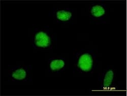 Abcam Anti-RNF144A antibody 50ug ab89260, Quantity: Each of 1