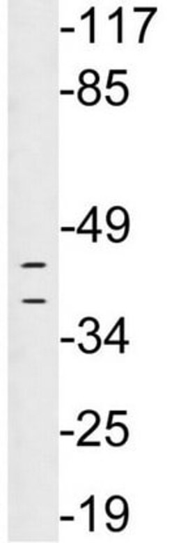 Abcam Anti-HLA Class I antibody 100 ¿g, Quantity: Each of 1