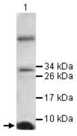 Abcam Anti-IL-13 antibody (ab106732) 100ug, Quantity: Each of 1