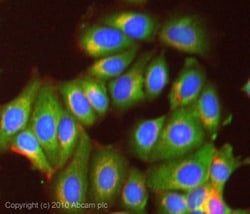 Abcam Anti-Osteoprotegerin antibody 100ug, Quantity: Each of 1