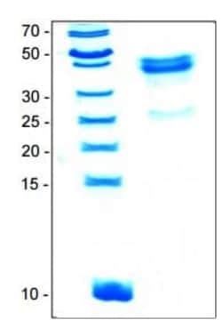 Abcam Recombinant Human Wnt5a protein, 25UG, Quantity: Each of 1