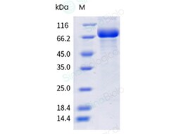Sino Biological Recombinant Mouse Transferrin Receptor/TFR1/CD71 Protein