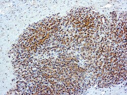 Diagnostic Biosystems GLYPICAN-3 (CL YP7) ANTI 1ML, Conc Mouse Monoclonal