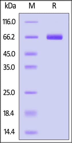 ACROBiosystems Mouse ALPG (ALPPL2) Recombinant Protein, C-terminal His