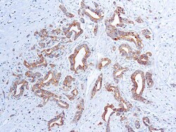 Diagnostic Biosystems&nbsp;VASCULAR ENDOTHELIAL GROWTH FA Vascular Endothelial Growth Factor (VEGF) (VG1)