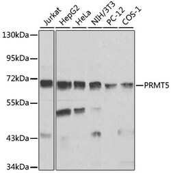 ABclonal Technology PRMT5 Rabbit pAb, Quantity: Each of 1