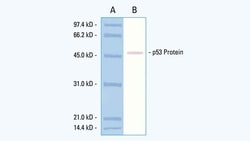 Leica Biosystems NCL-L-P53-CM5P 0.5ML, Quantity: Each of 1