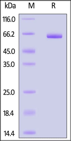 ACROBiosystems HUMAN ALPG/ALPPL2 PROTEIN HIS, Quantity: Each of 1