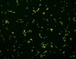 Brainxell Inc Terminally differentiated human spinal motor neurons; Derived