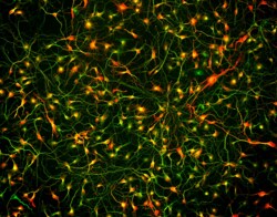 Brainxell Inc Cortical GABAergic Neurons (Human iPSC-Derived, Male Line,