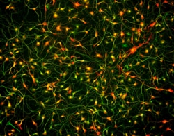 Brainxell Inc Cortical GABAergic Neurons (Human iPSC-Derived, Male Line,