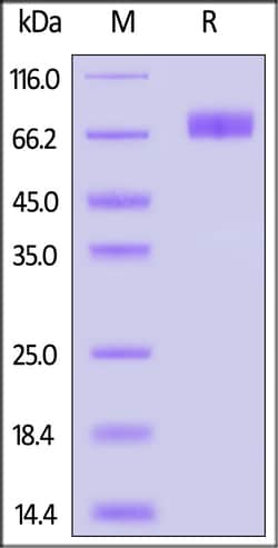 ACROBiosystems HUMAN IL-10 R ALPHA CD210 PRTN, Quantity: Each of 1