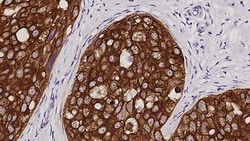 Leica Biosystems 1ML CYTOKERATIN MULTI AE1/AE, Quantity: Each of 1