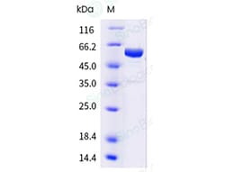 Sino Biological Influenza A H1N1 (A/California/04/2009) Hemagglutinin /
