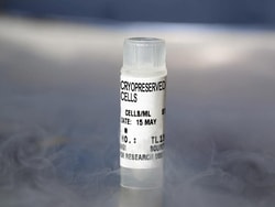 Lonza Walkersville NHOst – Human Osteoblasts, Quantity: Each of 1