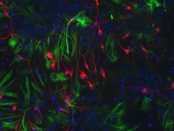 Lonza Walkersville Rat Brain Hypothalamus Neurons, Quantity: Each of 1