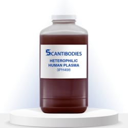 SCANTIBODIES LABORATORY INC HETEROPHILIC HUMAN PLASMA (3PH498), Quantity: