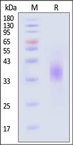 ACROBiosystems Human TROP-2 Protein, 100 μg, C-terminal Polyhistidine Tag,