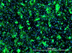 VITRO BIOPHARMA Human Glioblastoma Cancer-associated fibroblasts, 1,000,000