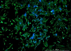 VITRO BIOPHARMA Human Prostate Cancer Associated Fibroblasts, 1,000,000 cells