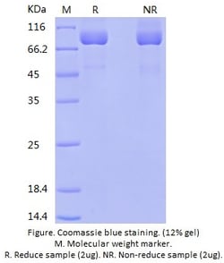 Bon Opus Biosciences&nbsp;Recombinant Human beta-Galactosidase/GLB1(C-His) - Source: Human 293 Cells