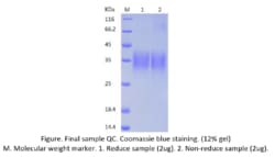 Bon Opus Biosciences Recombinant Human TREM-1 (C-His) - Source: Human 293